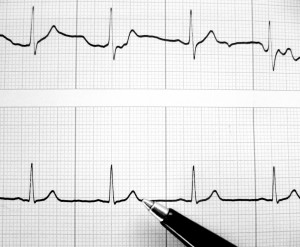 Die unendliche Geschichte: Patientenversorgung zur Unzeit
