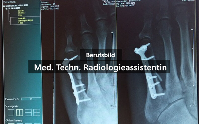 MTRA Medizinisch Technische Radiologie Assistentin