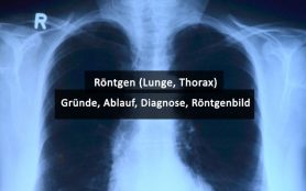 Röntgen Thorax Lunge