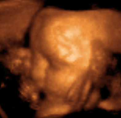 3D Ultraschall Gesicht Baby