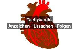 Tachykardie