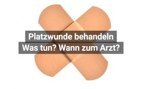 Platzwunde