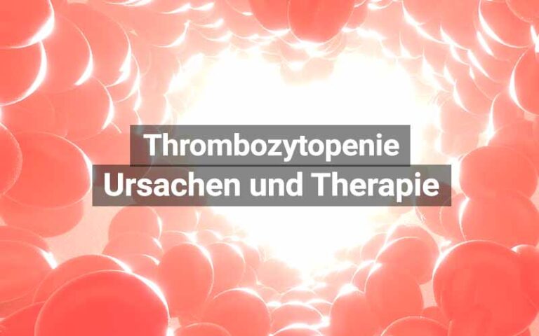 Thrombozytopenie: Zu wenige Blutplättchen | praktischArzt