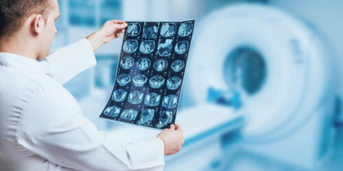 Doctor Looking MRI Picture.