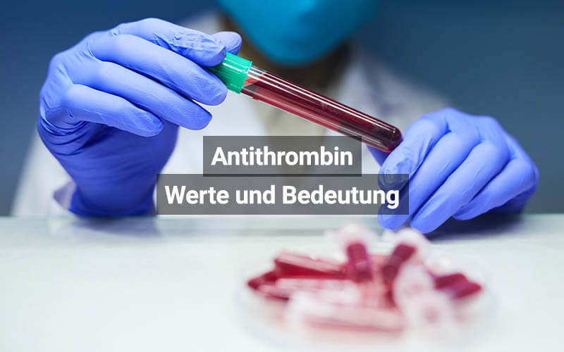 Antithrombin Werte Und Bedeutung