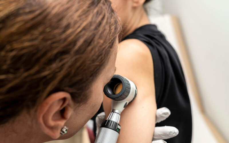 Dermatologie Hautkrebsscreening