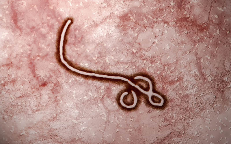 Mikroskopische Darstellung Ebolavirus