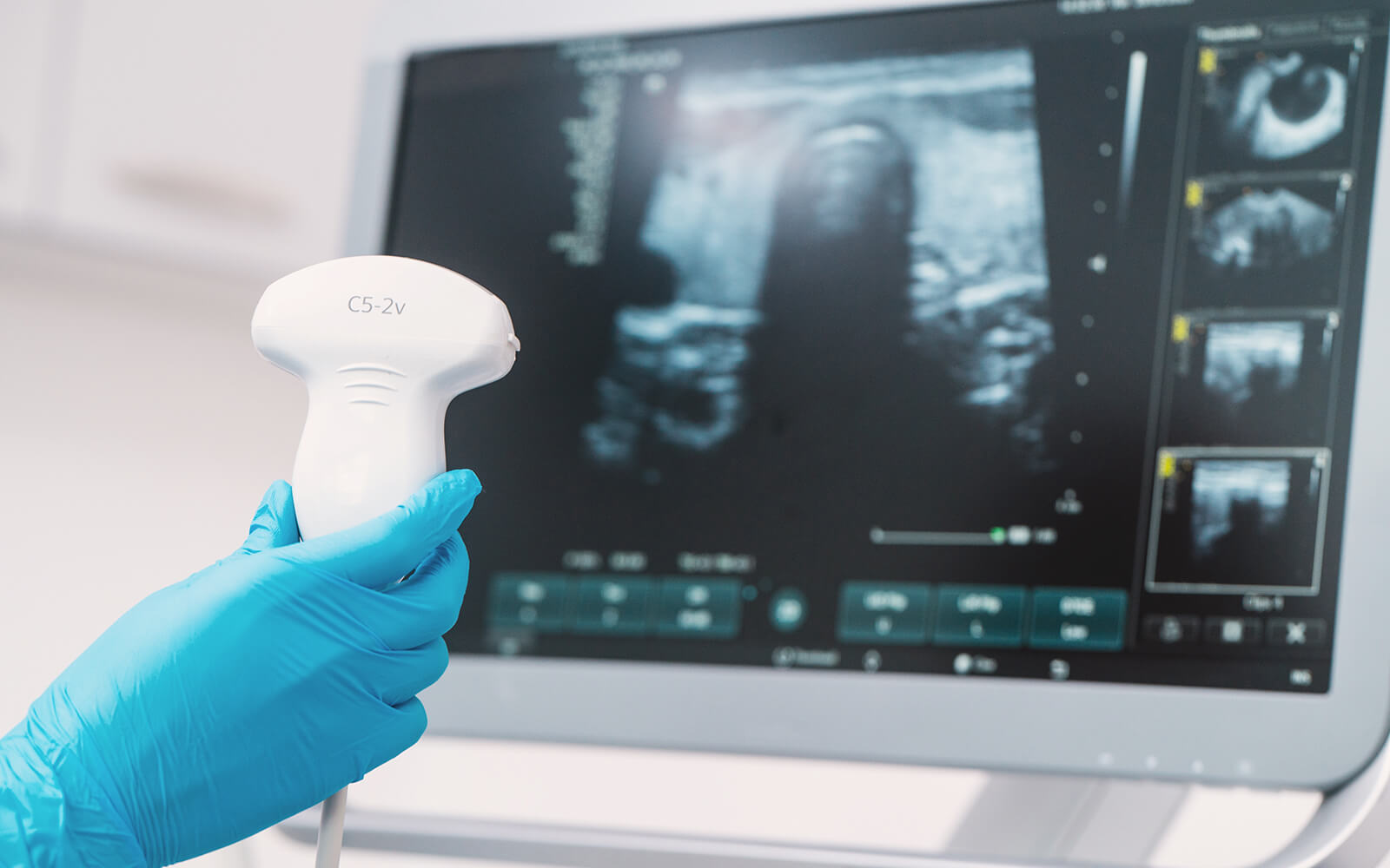 Sonographie Ultraschall