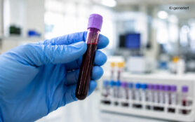 Albumin Werte Und Bedeutung