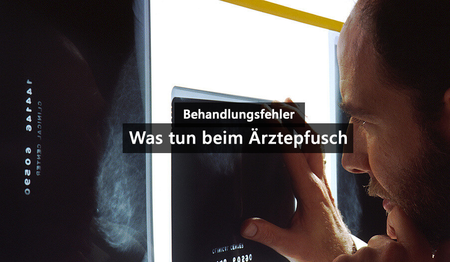 Behandlungsfehler